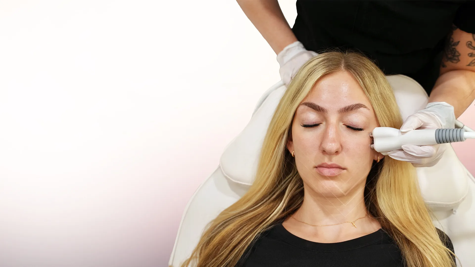 Venus Diamond Polar™ Facial Skin Tightening treatment at Toronto medical spa - Reverse Early Aging, Soften Lines & Rebuild Collagen Without Downtime...